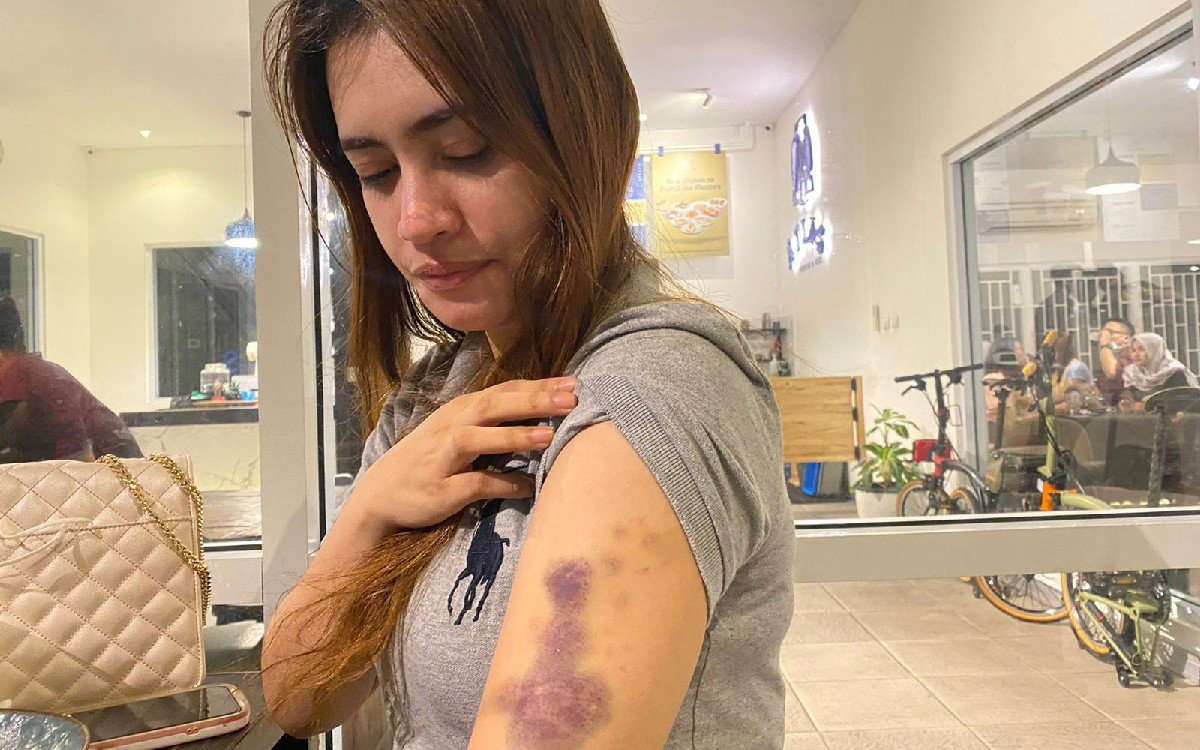 Perempuan Cantik Ngaku Dianiaya Oknum Polwan, Karena Berpacaran dengan Adik Pelaku